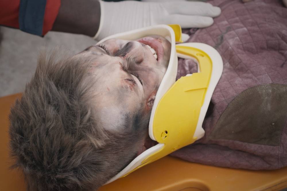 Life Care Planning in Florida Catastrophic Injury Cases: How Attorneys Prove Future Damages